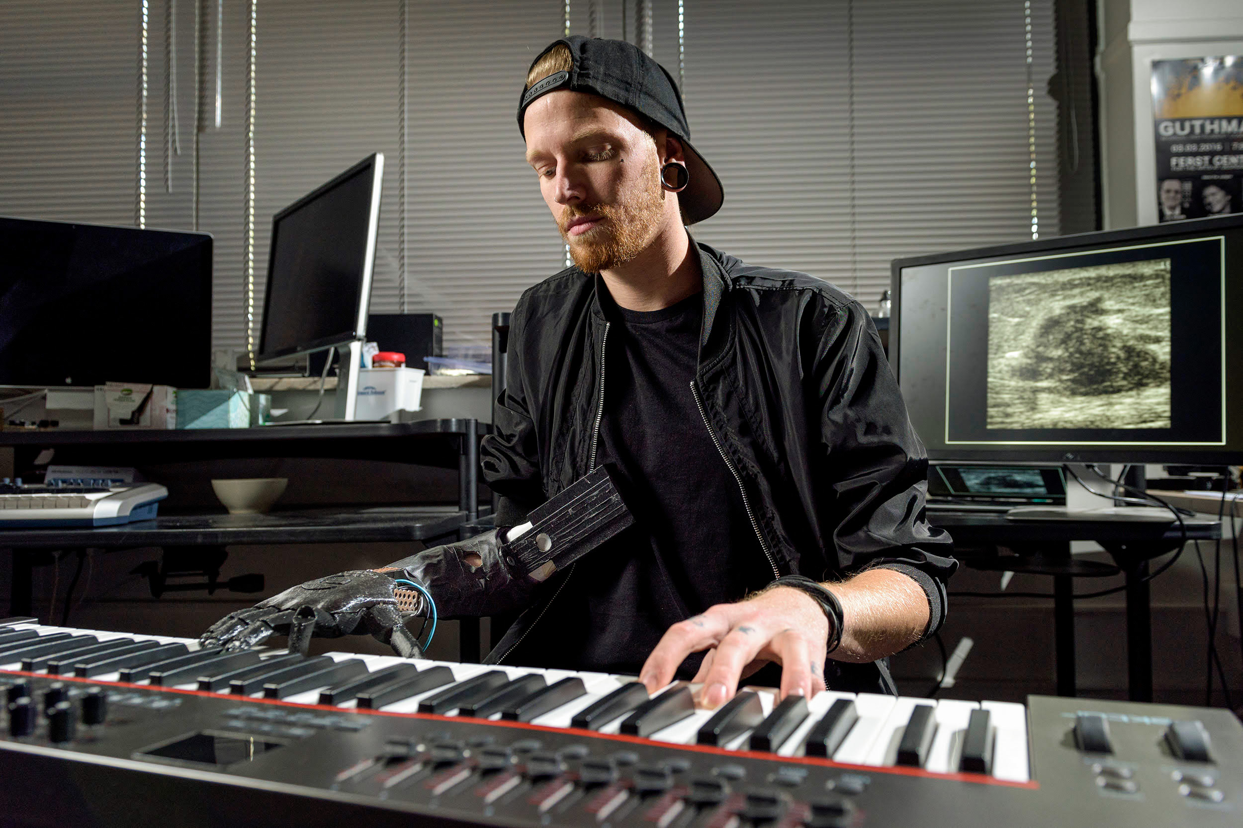 Barnes plays keyboard with prosthetic hand